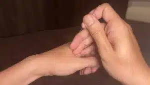 鍼治療の手元の様子