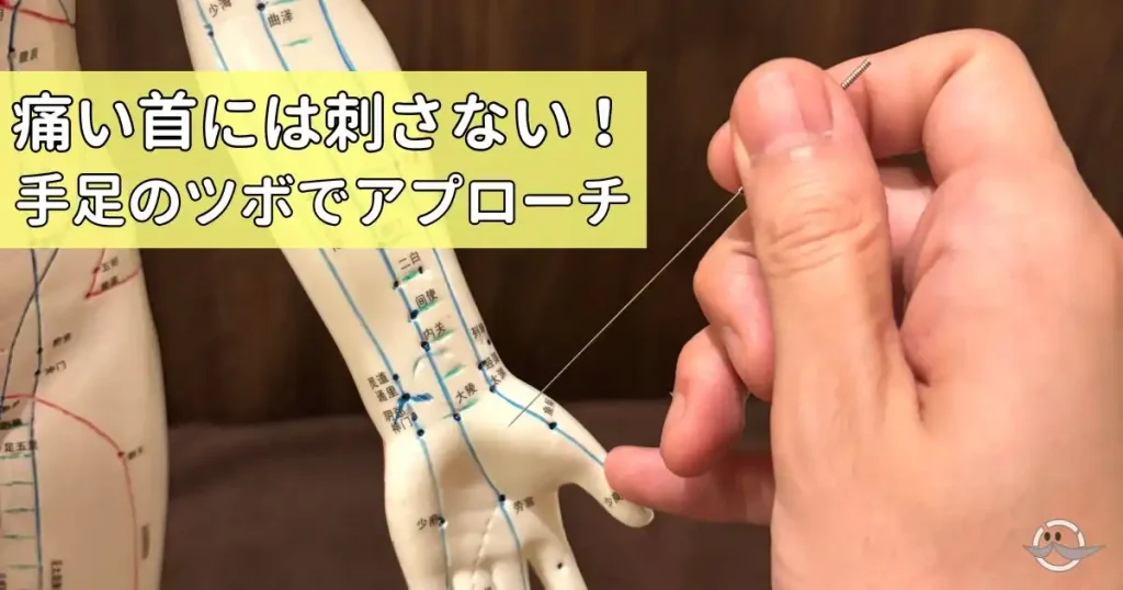 「痛い首には刺さない！手足のツボでアプローチ」という解説と共に、札幌クラーク治療院の米森院長が人体模型の足のツボ（董氏楊氏奇穴）へ鍼をしている様子