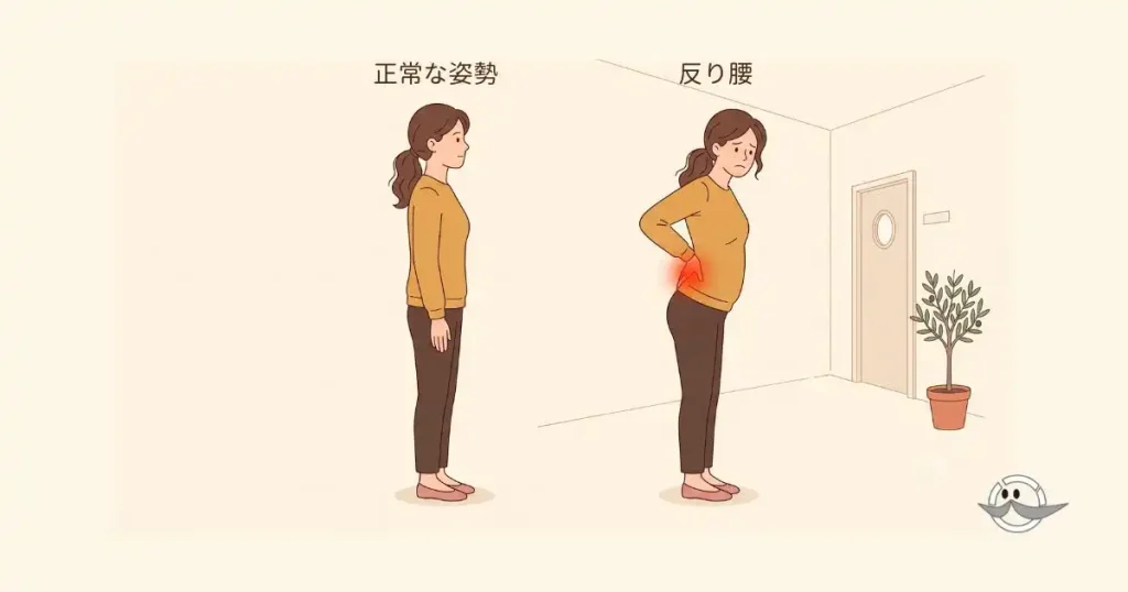 反り腰と正常な姿勢の比較と腰への負担