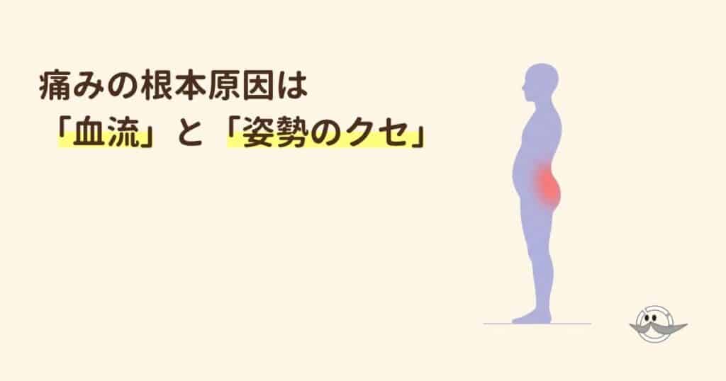 坐骨神経痛の根本原因である血流低下と反り腰の姿勢を示すイラスト